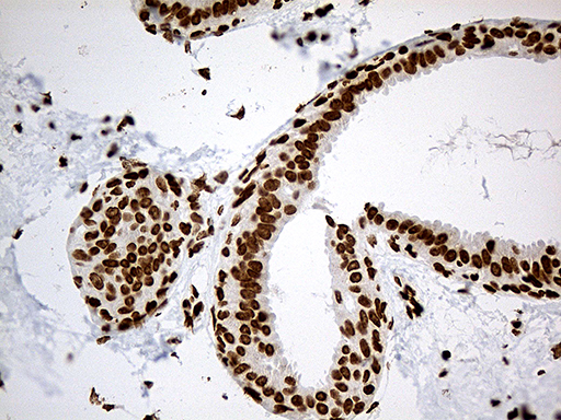 m11406 anti irf2bp1 mouse monoclonal antibody clone id oti3a6 ihc testing 4