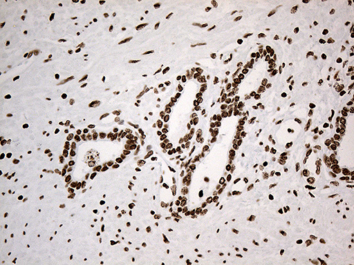 m11406 anti irf2bp1 mouse monoclonal antibody clone id oti3a6 ihc testing 5
