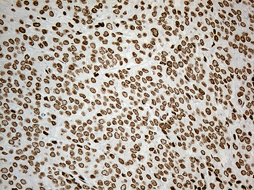 m11406 anti irf2bp1 mouse monoclonal antibody clone id oti3a6 ihc testing 6