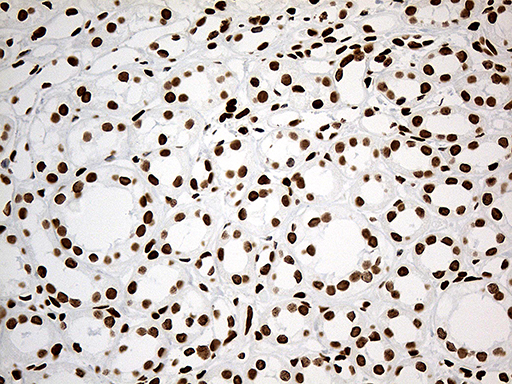 m11406 anti irf2bp1 mouse monoclonal antibody clone id oti3a6 ihc testing 7
