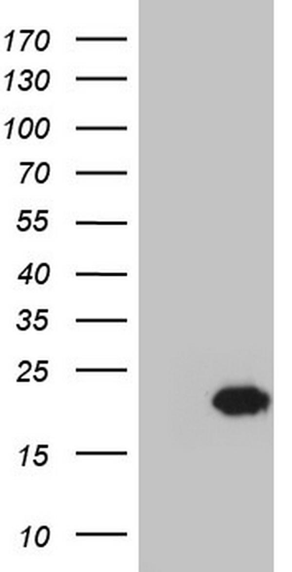 HEK293T cells were transfected with the pCMV6-ENTRY control (Left lane) or pCMV6-ENTRY CETN1 (Right lane) cDNA for 48 hrs and lysed