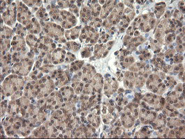 m11409 1 anti trim45 mouse monoclonal antibody clone id oti3g3 ihc testing 2