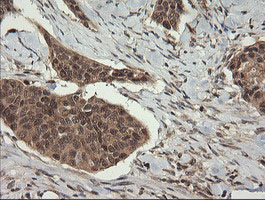 m11409 1 anti trim45 mouse monoclonal antibody clone id oti3g3 ihc testing 3