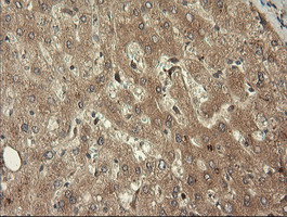 m11409 1 anti trim45 mouse monoclonal antibody clone id oti3g3 ihc testing 6