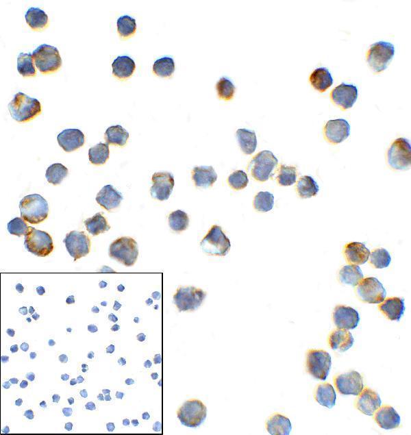 m11415 tmigd2 primary antibodies icc testing 2