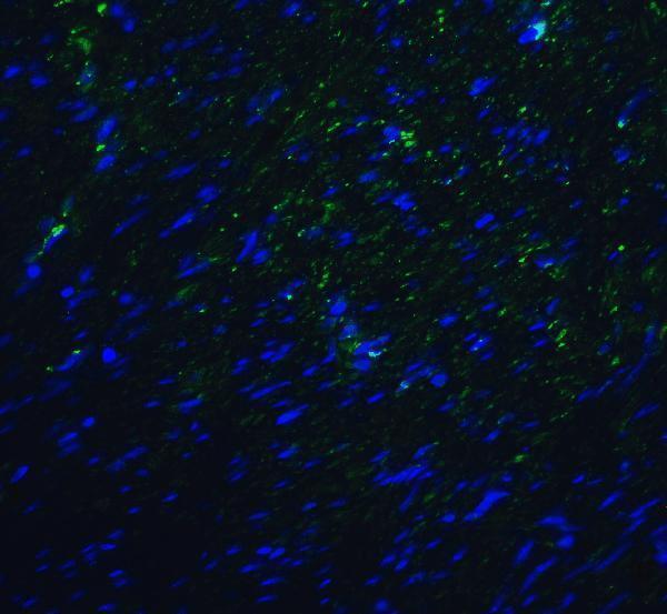 m11415 tmigd2 primary antibodies if testing 3