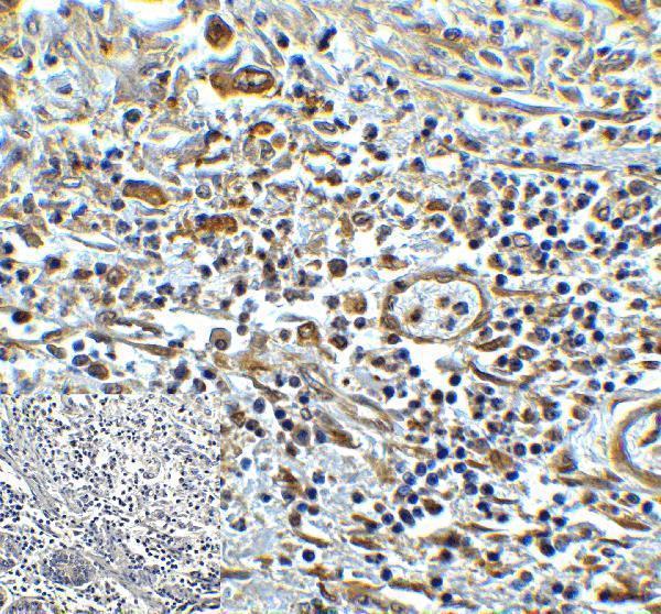 m11415 tmigd2 primary antibodies ihc testing 4