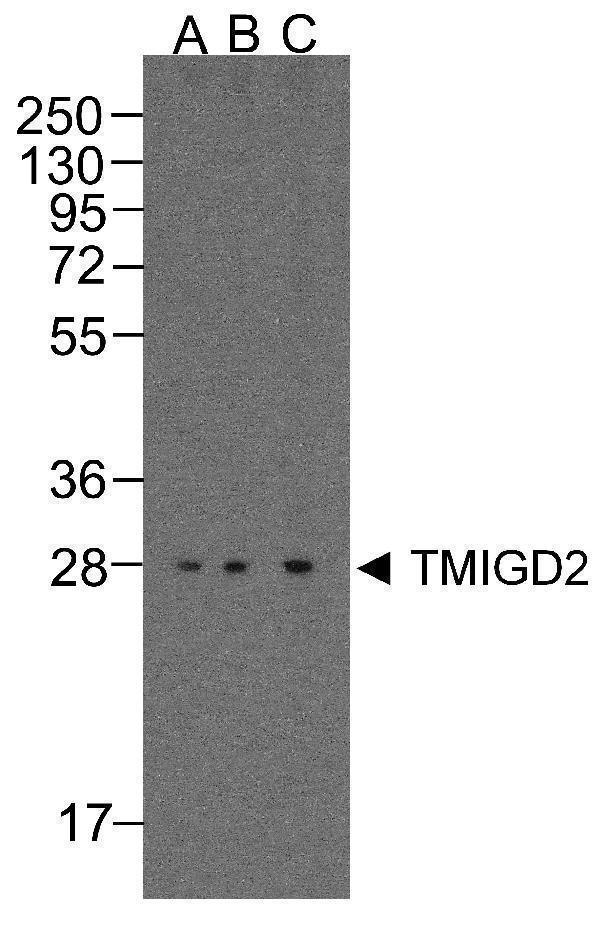 m11415 tmigd2 primary antibodies wb testing 1