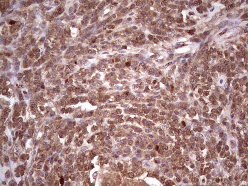 m11432 anti cdkl2 mouse monoclonal antibody clone id oti12c2 ihc testing 2