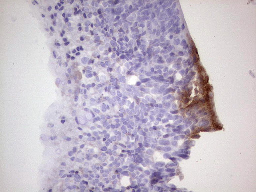 m11432 anti cdkl2 mouse monoclonal antibody clone id oti12c2 ihc testing 4