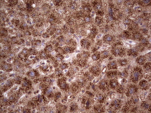 m11432 anti cdkl2 mouse monoclonal antibody clone id oti12c2 ihc testing 6