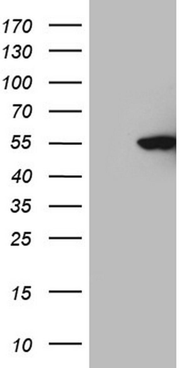 m11432 anti cdkl2 mouse monoclonal antibody clone id oti12c2 wb testing 1