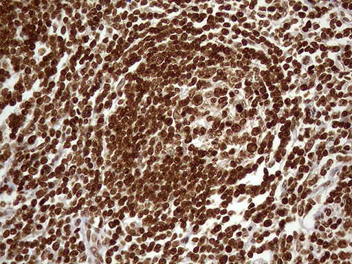 Immunohistochemical staining of paraffin-embedded Human lymph node tissue within the normal limits using anti-DDX19A mouse monoclonal antibody. (Heat-induced epitope retrieval by 1mM EDTA in 10mM Tris buffer (pH8.5) at 120°C for 3min