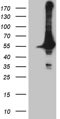 HEK293T cells were transfected with the pCMV6-ENTRY control (Left lane) or pCMV6-ENTRY DDX19A (Right lane) cDNA for 48 hrs and lysed. Equivalent amounts of cell lysates (5 ug per lane) were separated by SDS-PAGE and immunoblotted with anti-DDX19A (1:2000).