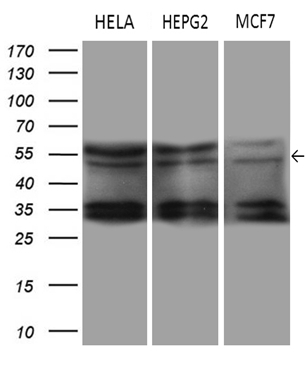 Western blot analysis of extracts (35ug) from 3 different cell lines by using anti-DDX19A monoclonal antibody (1:500).