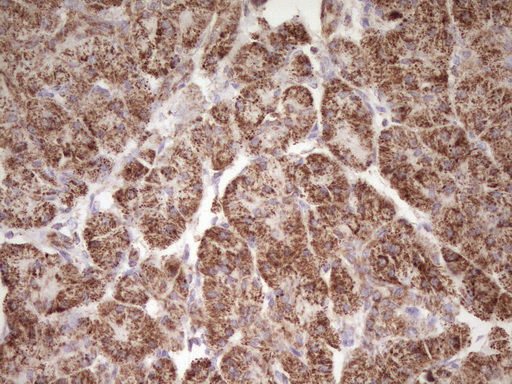 Immunohistochemical staining of paraffin-embedded Human pancreas tissue within the normal limits using anti-LRRC6 mouse monoclonal antibody. (Heat-induced epitope retrieval by 1 mM EDTA in 10mM Tris Immunohistochemical staining of paraffin-embedded Human pancreas tissue within the normal limits using anti-LRRC6 mouse monoclonal antibody. (Heat-induced epitope retrieval by 1 mM EDTA in 10mM Tris