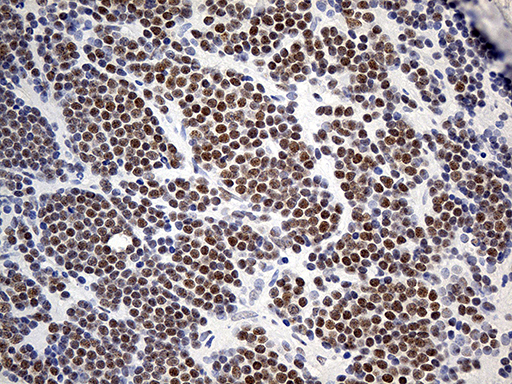 m11482 anti znf2 mouse monoclonal antibody clone id oti1g3 ihc testing 4