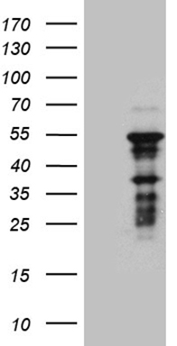 HEK293T cells were transfected with the pCMV6-ENTRY control (Left lane) or pCMV6-ENTRY ZNF2 (Right lane) cDNA for 48 hrs and lysed