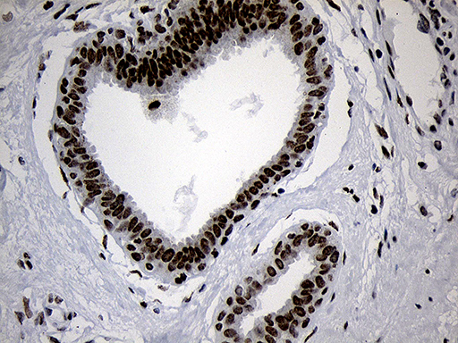 m11516 anti nabp1 mouse monoclonal antibody clone id oti6b10 ihc testing 6