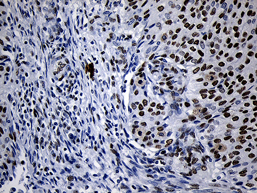m11516 anti nabp1 mouse monoclonal antibody clone id oti6b10 ihc testing 7