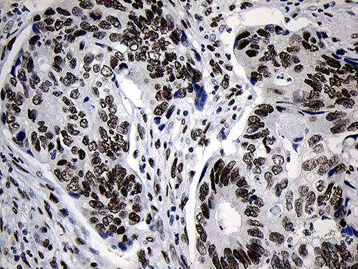 m11516 anti nabp1 mouse monoclonal antibody clone id oti6b10 ihc testing 8