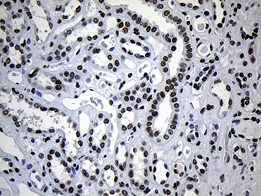 m11516 anti nabp1 mouse monoclonal antibody clone id oti6b10 ihc testing 9