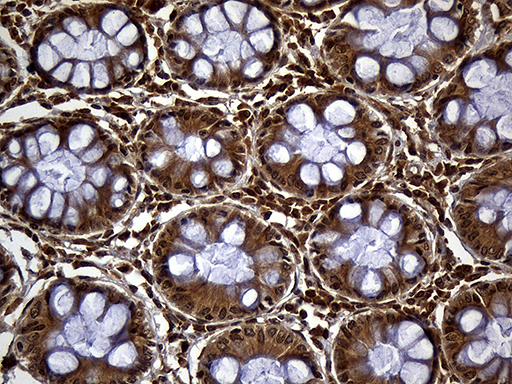 Immunohistochemical staining of paraffin-embedded Human colon tissue within the normal limits using anti-SEC11A mouse monoclonal antibody