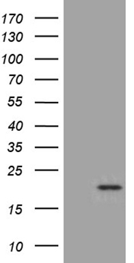HEK293T cells were transfected with the pCMV6-ENTRY control (Left lane) or pCMV6-ENTRY SEC11A (Right lane) cDNA for 48 hrs and lysed