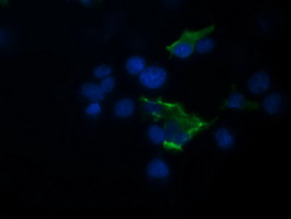 m11544 anti trim44 mouse monoclonal antibody clone id oti1e10 if testing 12