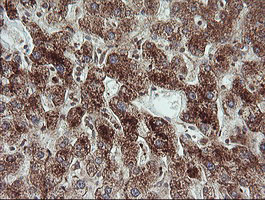 m11544 anti trim44 mouse monoclonal antibody clone id oti1e10 ihc testing 10