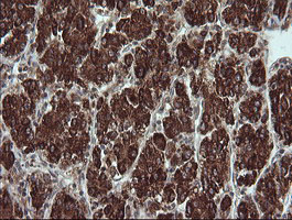 m11544 anti trim44 mouse monoclonal antibody clone id oti1e10 ihc testing 11