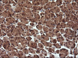 m11544 anti trim44 mouse monoclonal antibody clone id oti1e10 ihc testing 3