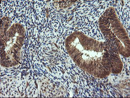 m11544 anti trim44 mouse monoclonal antibody clone id oti1e10 ihc testing 4