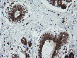 m11544 anti trim44 mouse monoclonal antibody clone id oti1e10 ihc testing 5