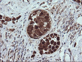 m11544 anti trim44 mouse monoclonal antibody clone id oti1e10 ihc testing 6