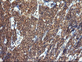 m11544 anti trim44 mouse monoclonal antibody clone id oti1e10 ihc testing 7