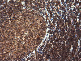 m11544 anti trim44 mouse monoclonal antibody clone id oti1e10 ihc testing 8