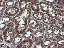 m11544 anti trim44 mouse monoclonal antibody clone id oti1e10 ihc testing 9