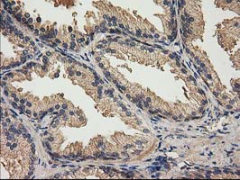 Immunohistochemical staining of paraffin-embedded Human prostate tissue within the normal limits using anti-ACOT12 mouse monoclonal antibody