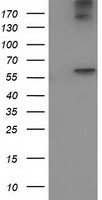 HEK293T cells were transfected with the pCMV6-ENTRY control (Left lane) or pCMV6-ENTRY ACOT12 (Right lane) cDNA for 48 hrs and lysed