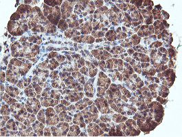 m11618 anti c5orf19 reep2 mouse monoclonal antibody clone id oti2c7 ihc testing 2