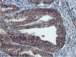 m11618 anti c5orf19 reep2 mouse monoclonal antibody clone id oti2c7 ihc testing 3