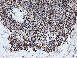 m11618 anti c5orf19 reep2 mouse monoclonal antibody clone id oti2c7 ihc testing 4