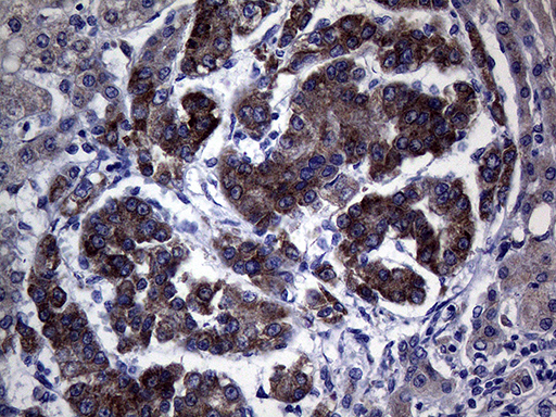 m11622 anti c20orf7 ndufaf5 mouse monoclonal antibody clone id oti6a9 ihc testing 4