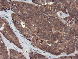 m11627 1 anti rassf8 mouse monoclonal antibody clone id oti3f7 ihc testing 2