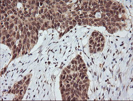 m11627 1 anti rassf8 mouse monoclonal antibody clone id oti3f7 ihc testing 5