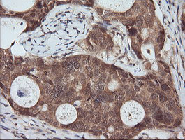 m11627 1 anti rassf8 mouse monoclonal antibody clone id oti3f7 ihc testing 6