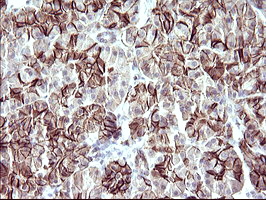 Immunohistochemical staining of paraffin-embedded Human pancreas tissue within the normal limits using anti-RASSF8 mouse monoclonal antibody