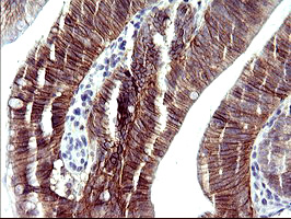 m11627 anti rassf8 mouse monoclonal antibody clone id oti1f5 ihc testing 4