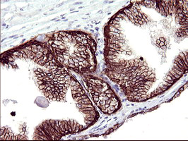 m11627 anti rassf8 mouse monoclonal antibody clone id oti1f5 ihc testing 5